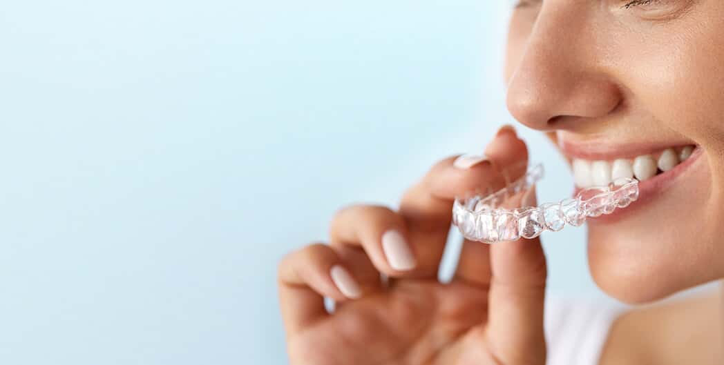 Invisalign