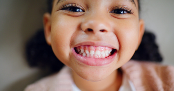 Ask A Kid Friendly Dentist: Minimizing The Dental Effects Of Thumb Sucking