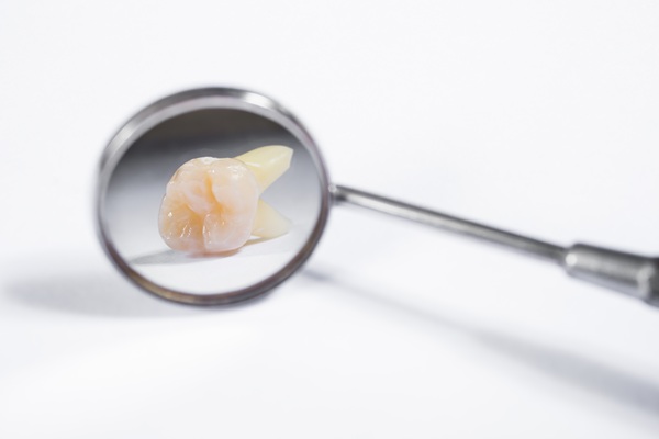 How Soon Can I Drink Alcohol Or Consume Other Foods After A Tooth Extraction?